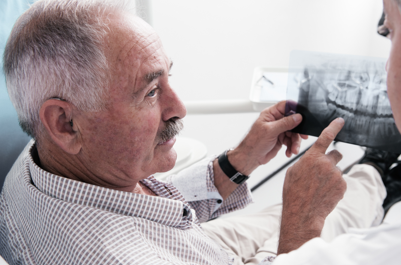 Man pointing at dental x-ray